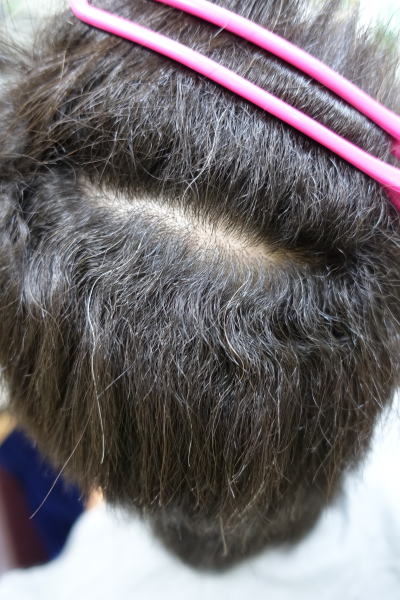 ���x���k�ы�������Ɣ����Y�݂����ɂȂ�