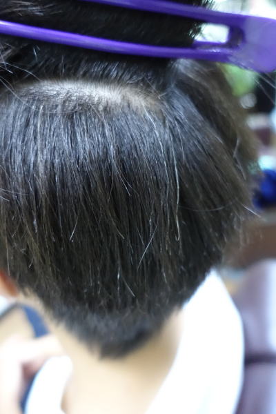 ���x���k�ы�������Ɣ����Y�݂����ɂȂ�