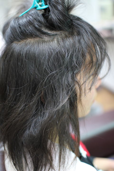 ���񂾔��͏k�ы����̖�܂�A�C�����̔M�ɑς�����̗͂��c���ĂȂ��āA�������Ď{�p����ƃ`���`���т�r�r���тɂ�댯���������Ȃ�܂��B