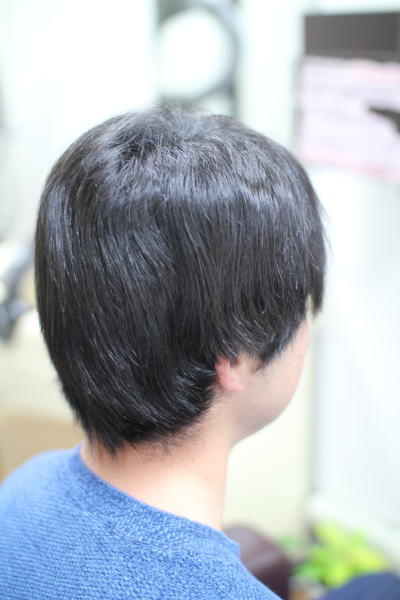 �ѐ�͊��S�K�[�h�̏k�ы���