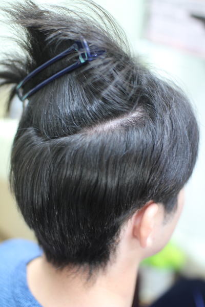 �ѐ�͊��S�K�[�h�̏k�ы���